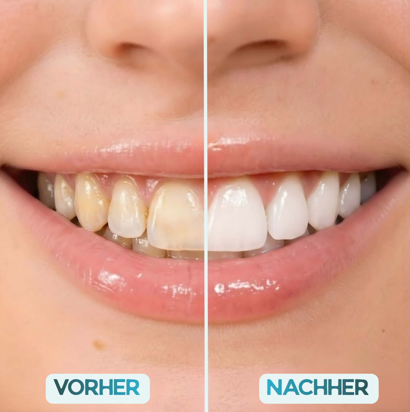 Unrealé Starter Kit (2+1 Gratis)