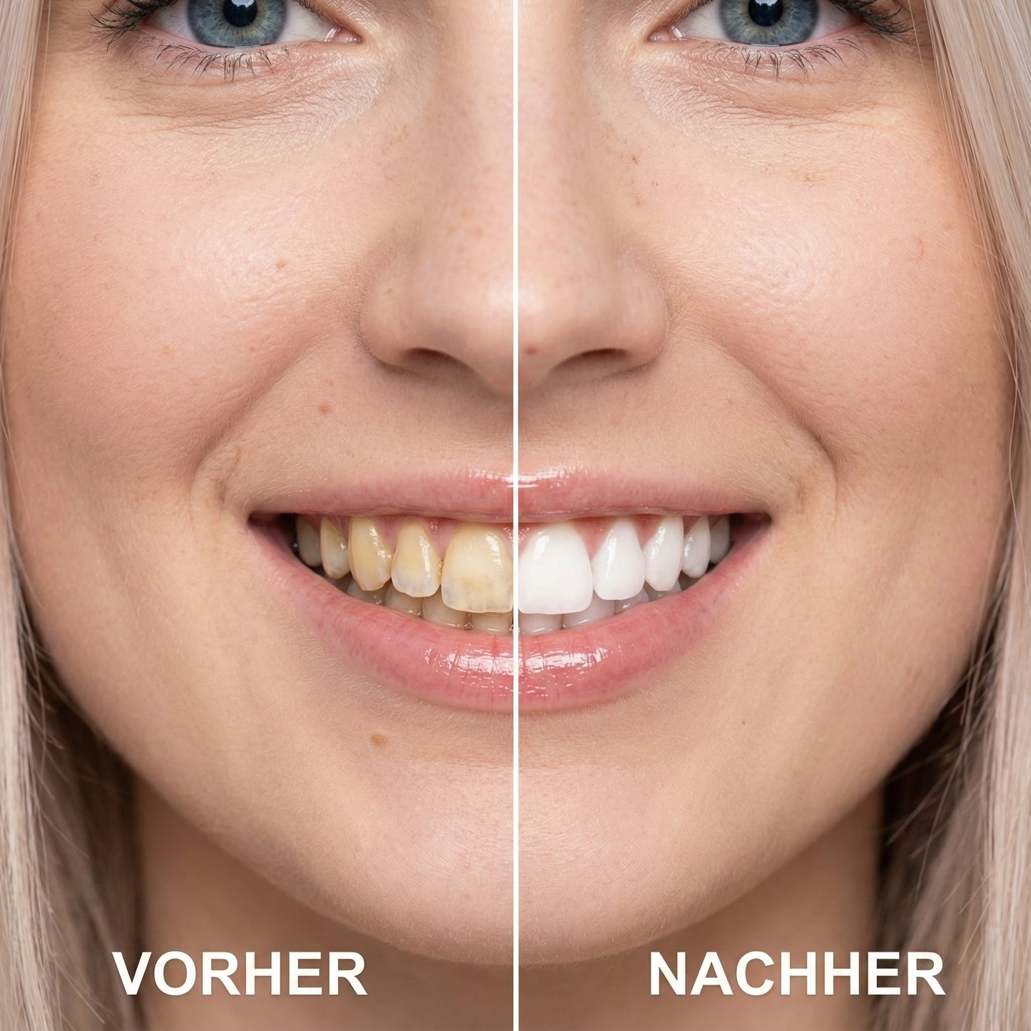 Unrealé Smile Refiner™ Pre Order