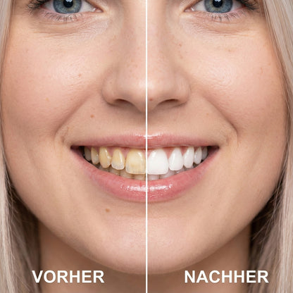 Unrealé Smile Refiner™ Pre Order
